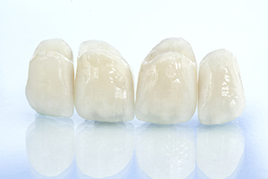 POINT 9.技工物の精度を上げる「歯科技工士の立ち会い」 イメージ画像