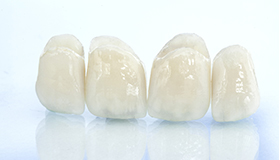oint09 技工物の精度を上げる 歯科技工士の立会い イメージ画像